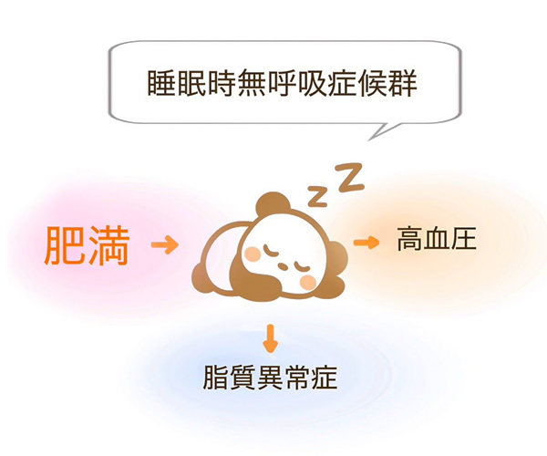 睡眠時無呼吸症候群